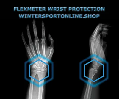 Flexmeter keeps the wrist from bending deeply